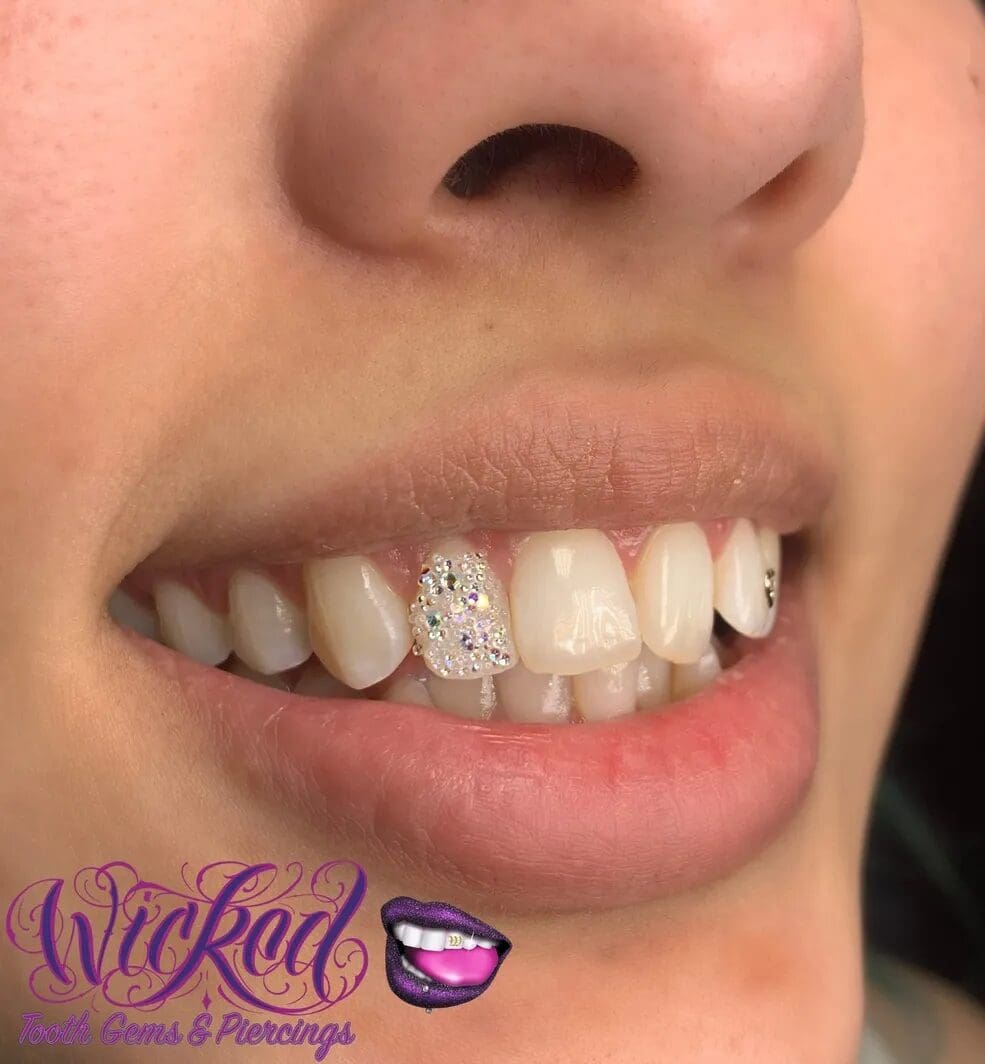 Chandelier Tooth Training Class & Kit image 0