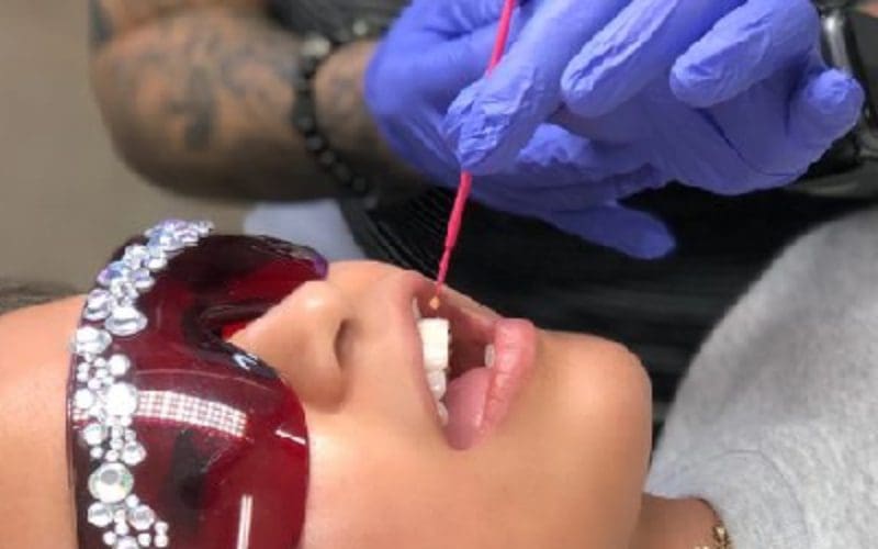 A person is getting their teeth gemmed
