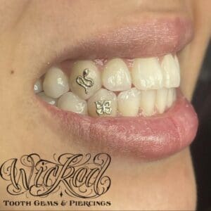 Tooth GEMS  Strictly Tailored