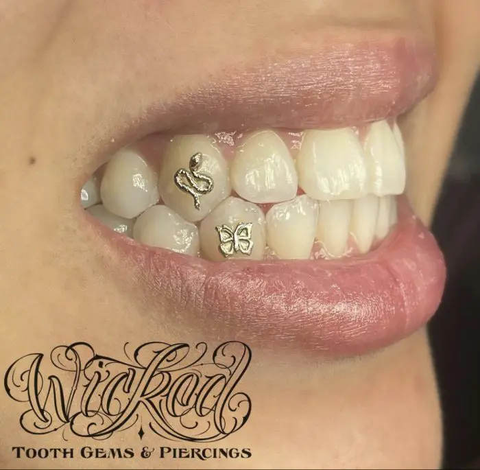 A woman with white teeth and black lettering on her smile.