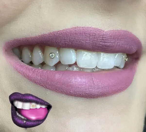 A woman with purple lips and teeth smiling.