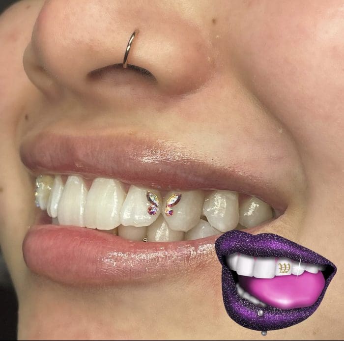 A woman with purple lips and white teeth.