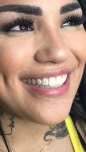 A close up of a person smiling with teeth