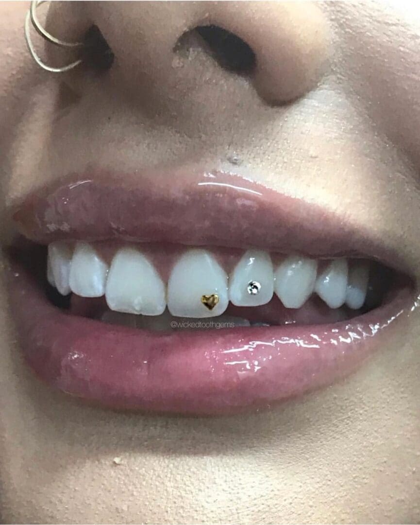 Styles & Beauty L.L.C - New service ALERT ! Swarovski & gold Gems! What is  a Tooth Gem? tooth gems are Swarovski Crystals or gold shapes or emblems  design for your teeth