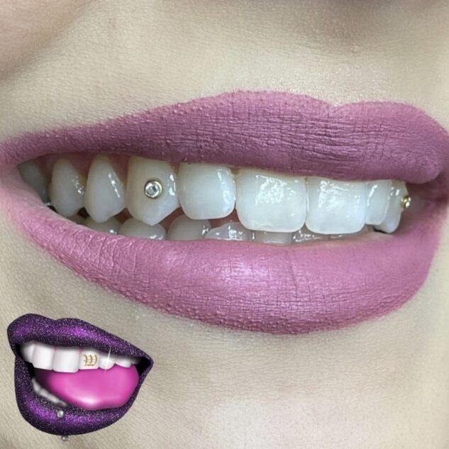 A woman with purple lips and teeth smiling.